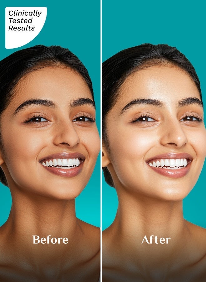 بيلجريم مرطب بيلغريم سكوالين ونياسيناميد وفيتامين سي للوجه (50 جم) | مرطب للبشرة الجافة | مرطب للوجه بفيتامين سي لبشرة متألقة | غير دهني | للجنسين - Image 5